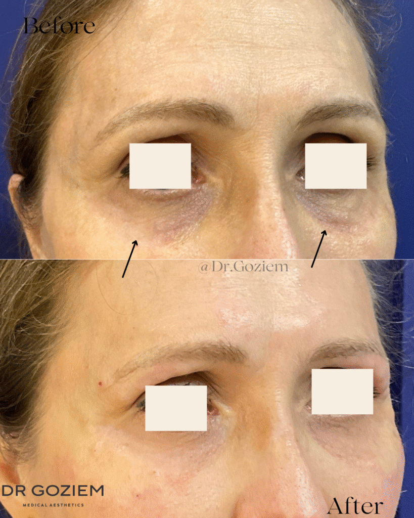 Aesthetic consultation 6