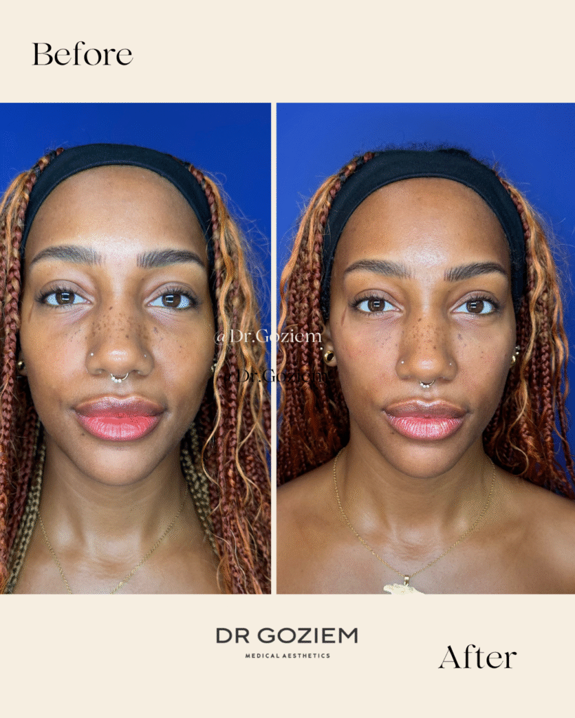 Aesthetic consultation 7
