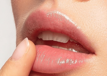 Lip filler+hyaluronic acid to add volume, shape, and definition to the lips+hyaluronic acid helps retain moisture and plumpness